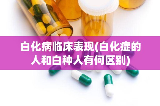 白化病临床表现(白化症的人和白种人有何区别)