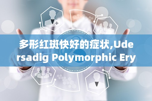 多形红斑快好的症状,Udersadig Polymorphic Eryhema: Sympoms ad Fas Recovery