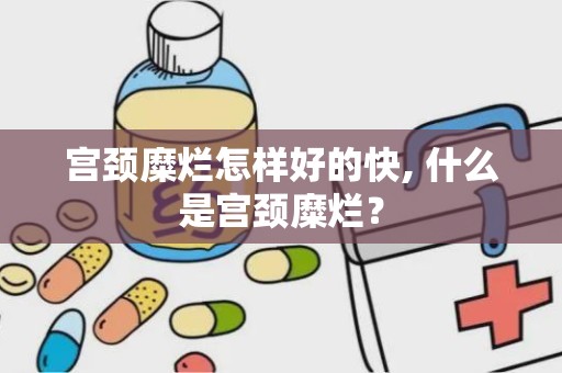 宫颈糜烂怎样好的快, 什么是宫颈糜烂？