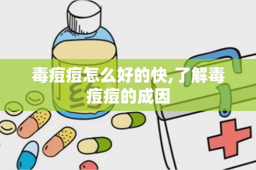 毒痘痘怎么好的快,了解毒痘痘的成因