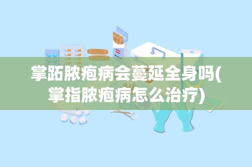 掌跖脓疱病会蔓延全身吗(掌指脓疱病怎么治疗)