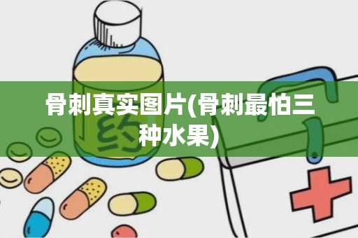 骨刺真实图片(骨刺最怕三种水果)