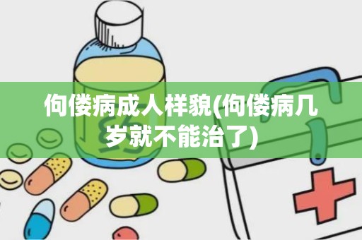 佝偻病成人样貌(佝偻病几岁就不能治了)