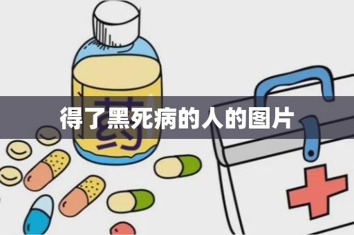 得了黑死病的人的图片