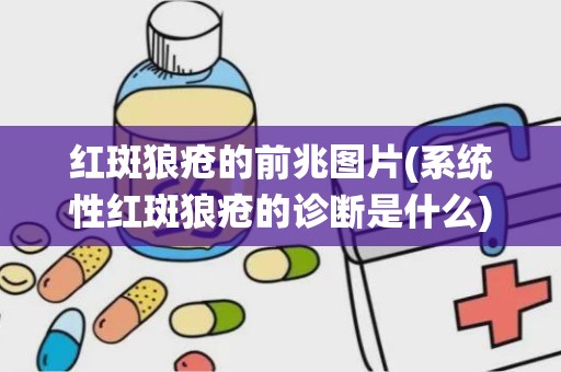 红斑狼疮的前兆图片(系统性红斑狼疮的诊断是什么)