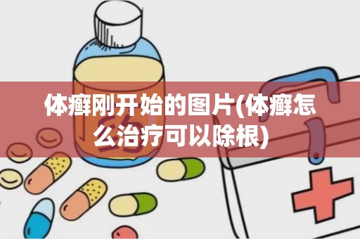 体癣刚开始的图片(体癣怎么治疗可以除根)