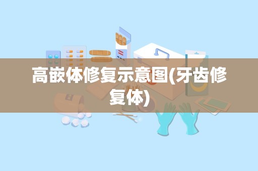 高嵌体修复示意图(牙齿修复体)